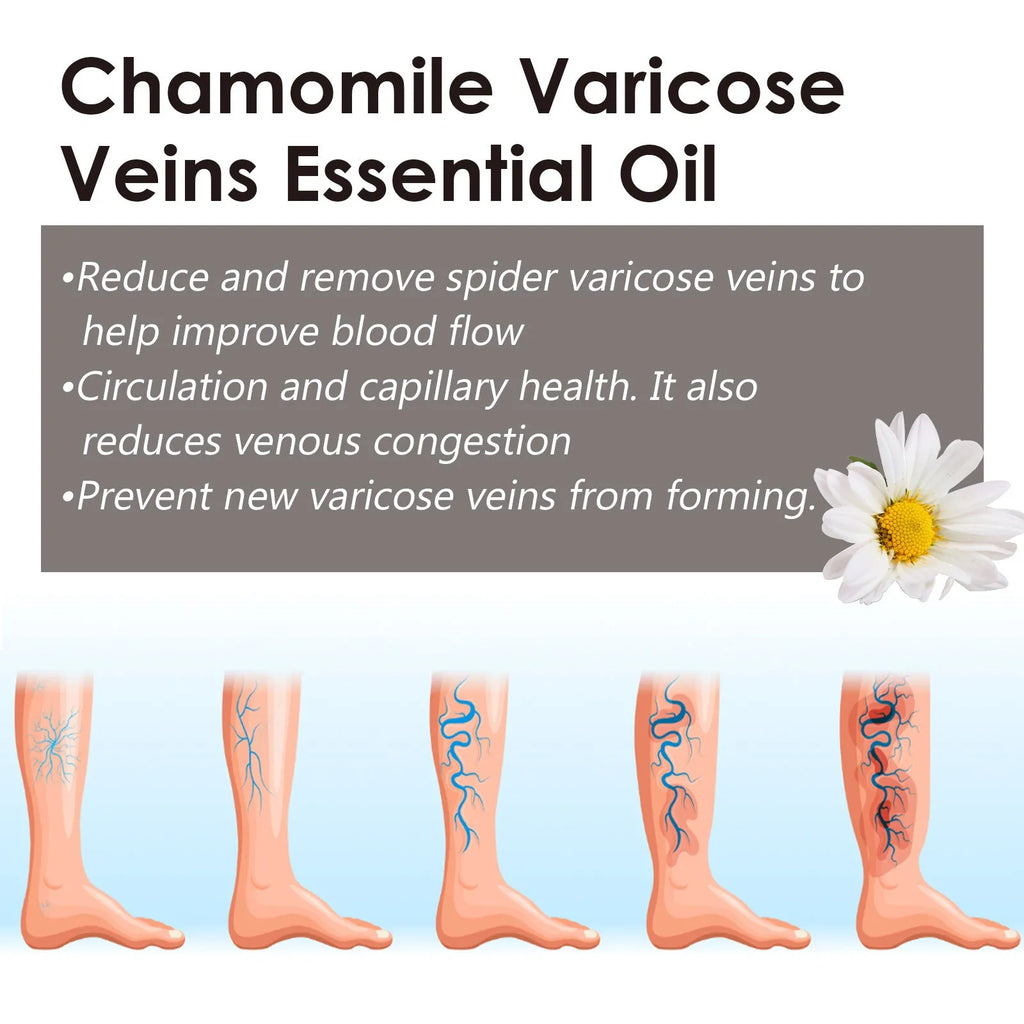 10ml Chamomile Leg Essential Oil bottle for leg skin care and massage