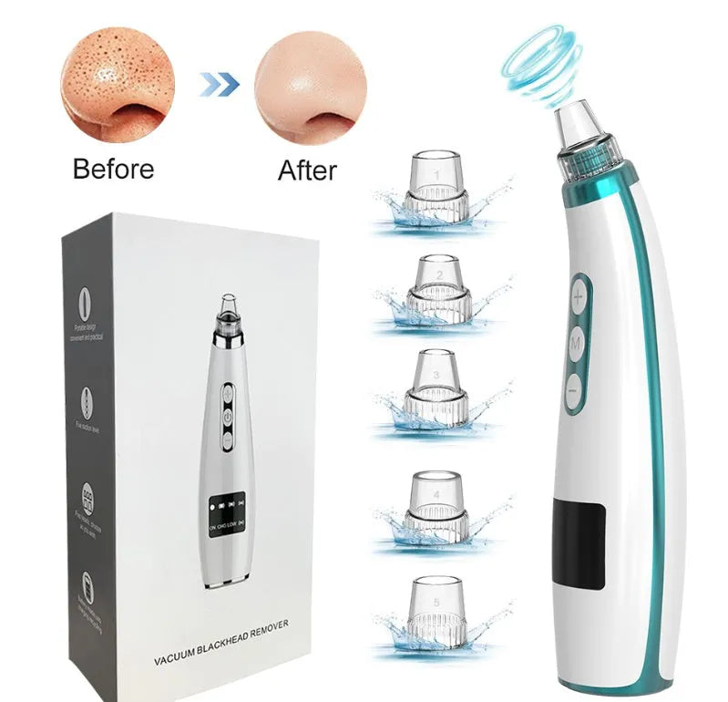 Black electric blackhead suction instrument with USB power, 5-gear suction, 450mAh battery, 133g, 173x44x40mm