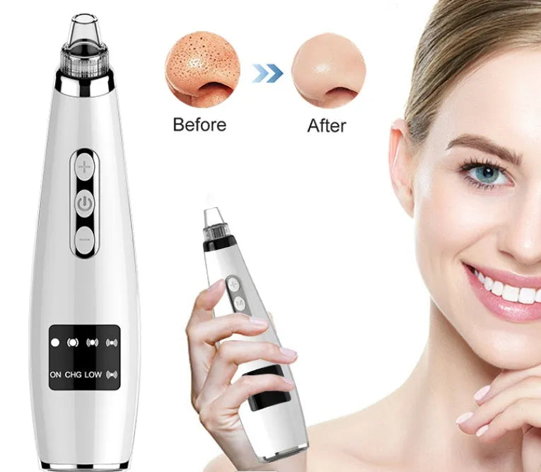 Black electric blackhead suction instrument with USB power, 5-gear suction, 450mAh battery, 133g, 173x44x40mm