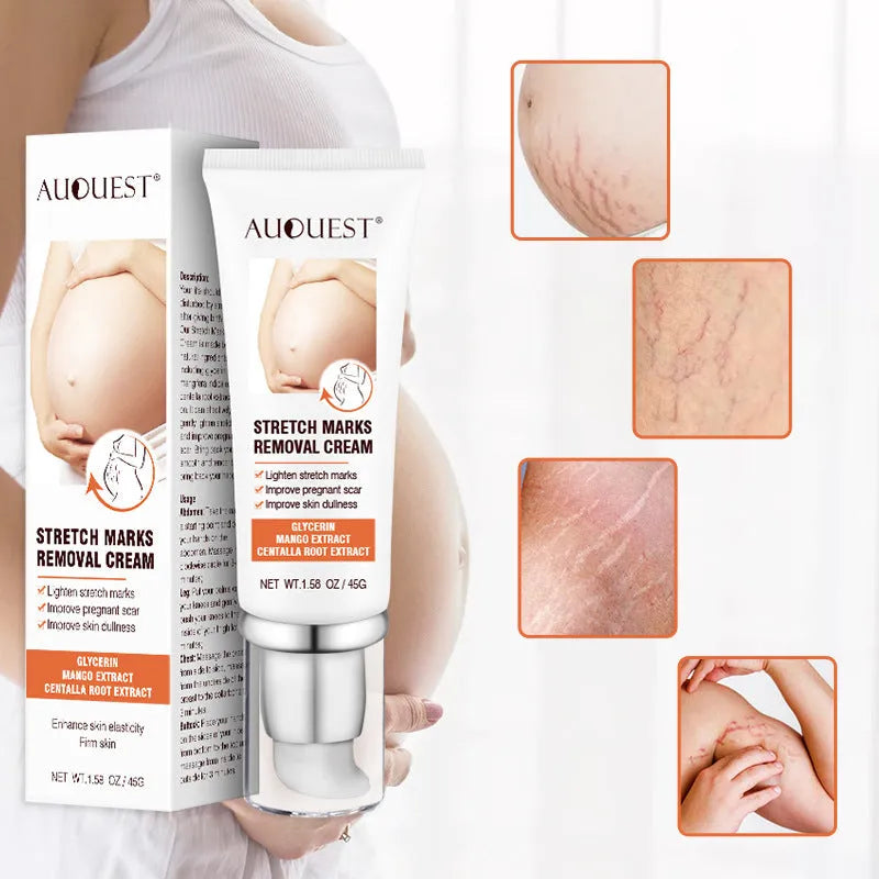 White stretch mark cream in a 45g pot, with ingredients including grape seed oil and jojoba seed oil