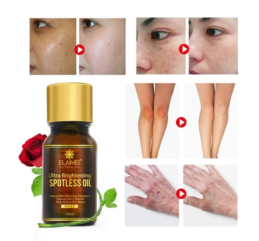 Ultra Brightening Spotless Oil 10ml bottle with rose and citrus extracts for brightening