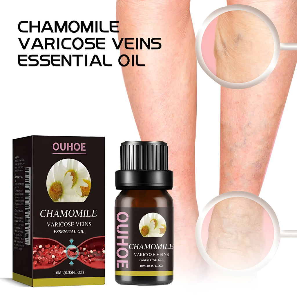 10ml Chamomile Leg Essential Oil bottle for leg skin care and massage