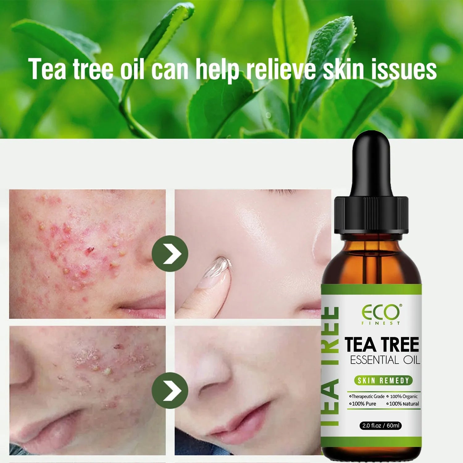 60ml glass bottle of tea tree essential oil with dropper for skincare and massage use