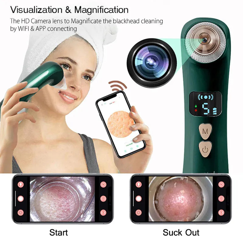 Rechargeable blackhead remover with hot compress, 54KPA suction, app control, green or white, USB charging