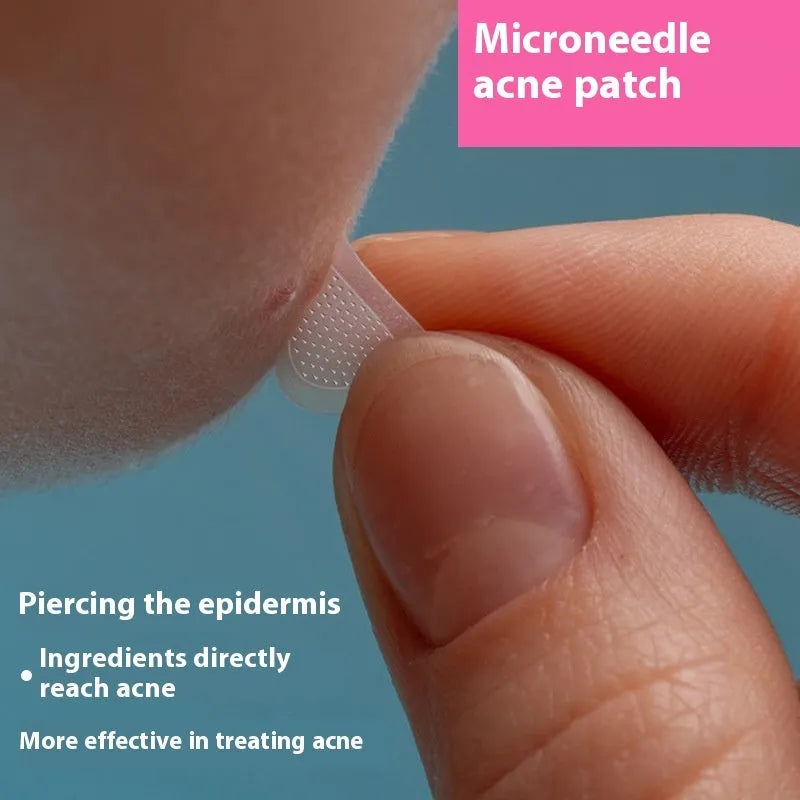 Soluble hyaluronic acid microneedle acne patches sheet with 9 circular 14mm patches