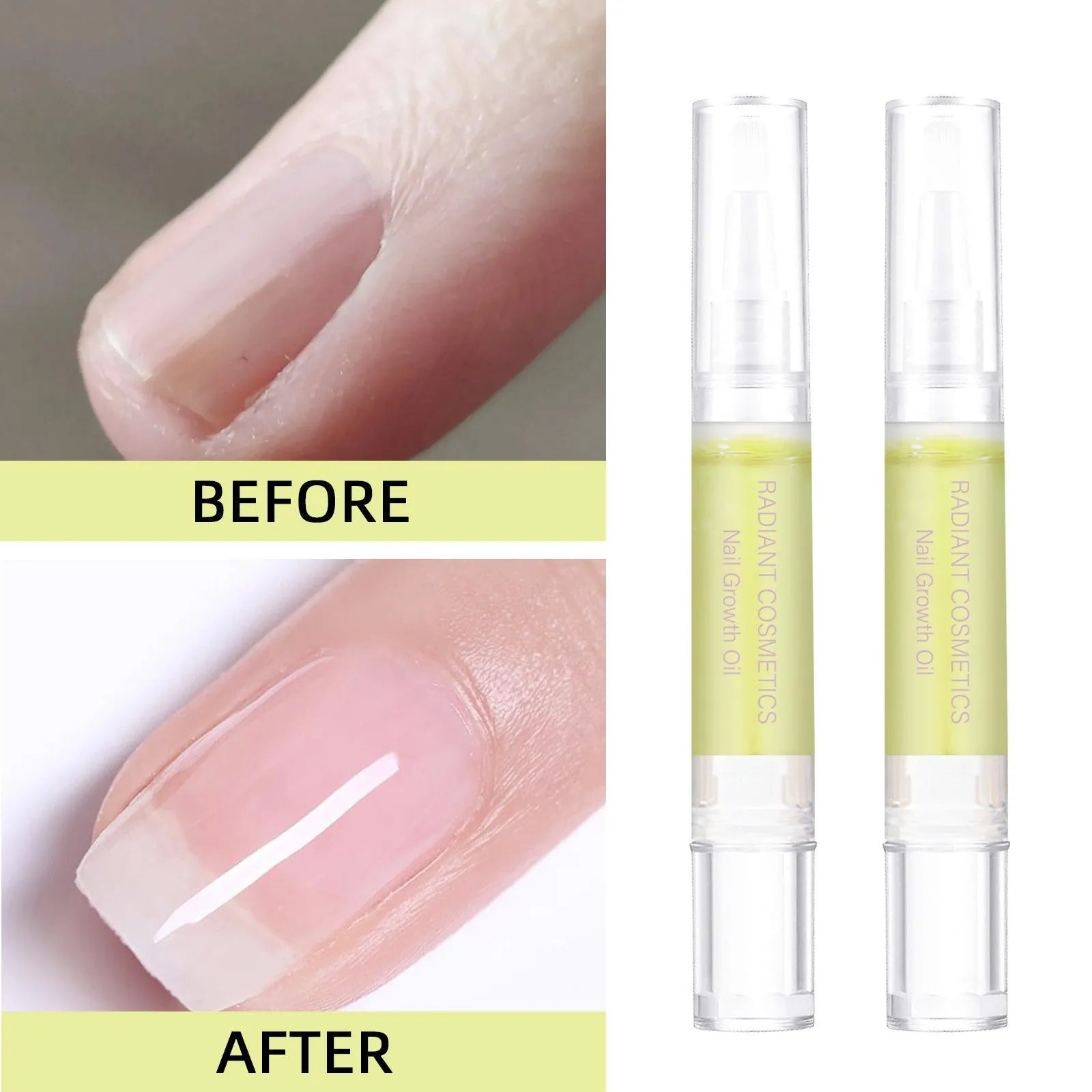3ml bottle of nail growth care oil with wash-free formula for moisture promotion