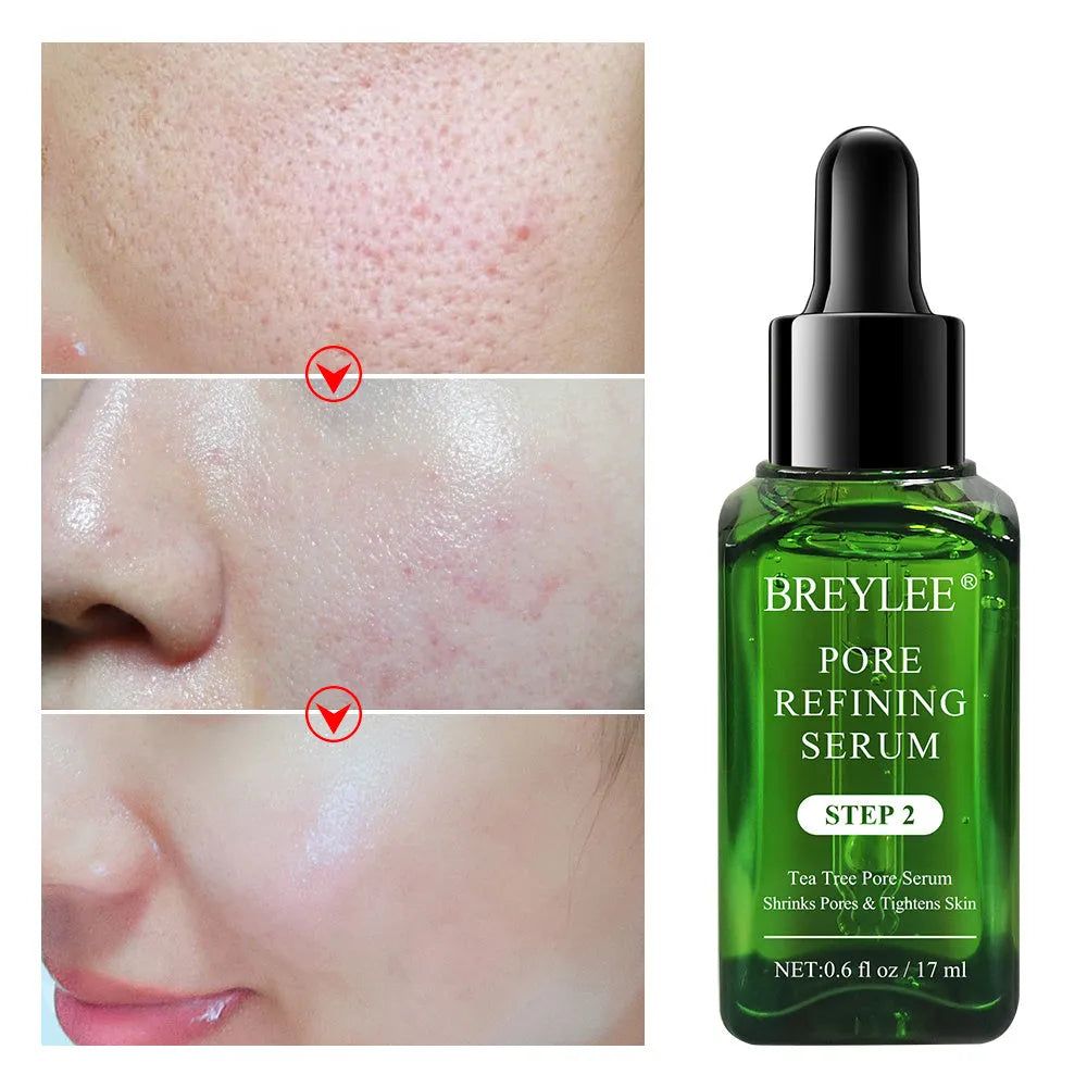 BREYLEE tea tree pore shrinking serum 17ml bottle for oil control face serum