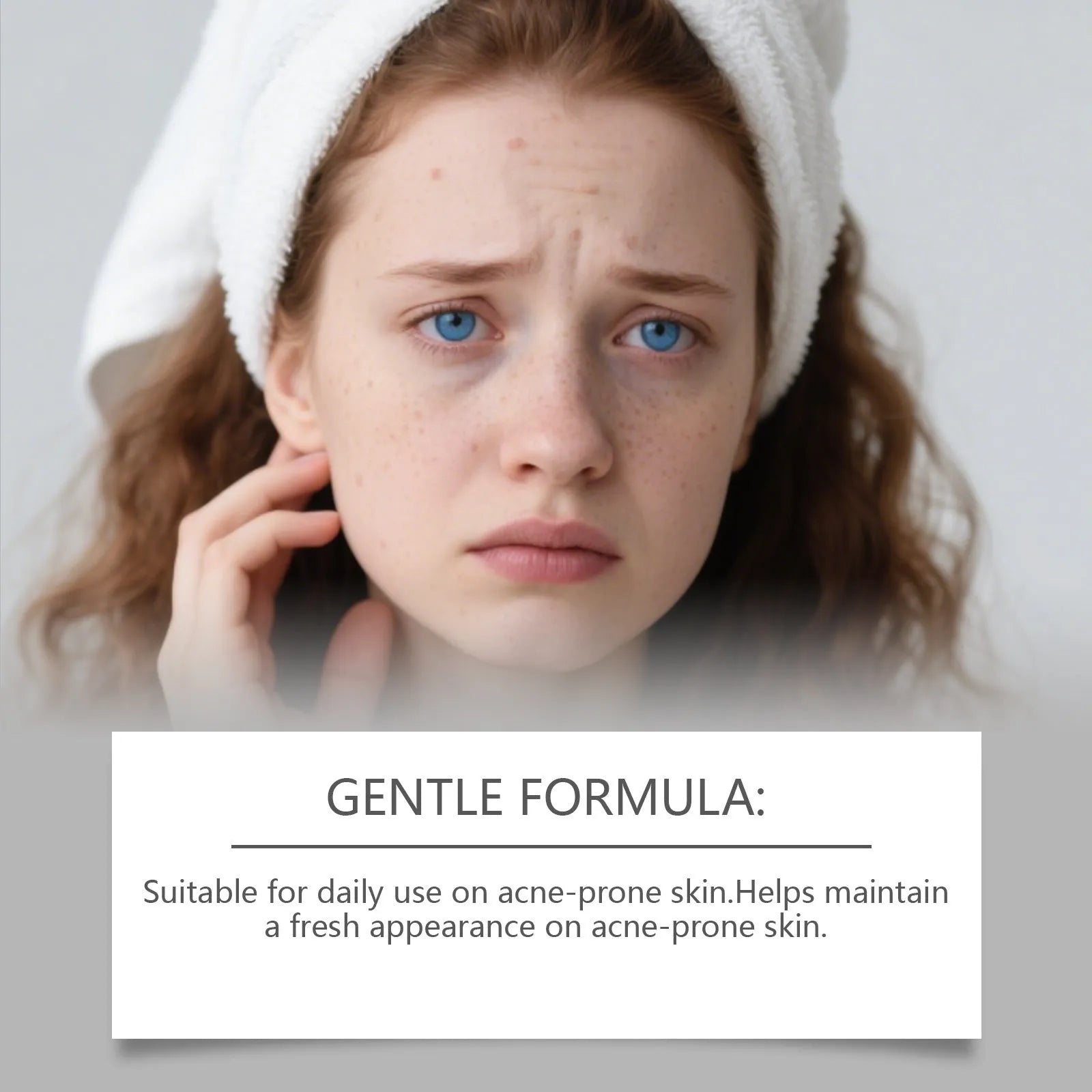Pack of 80 gentle breathable facial acne patches for daily blemish care