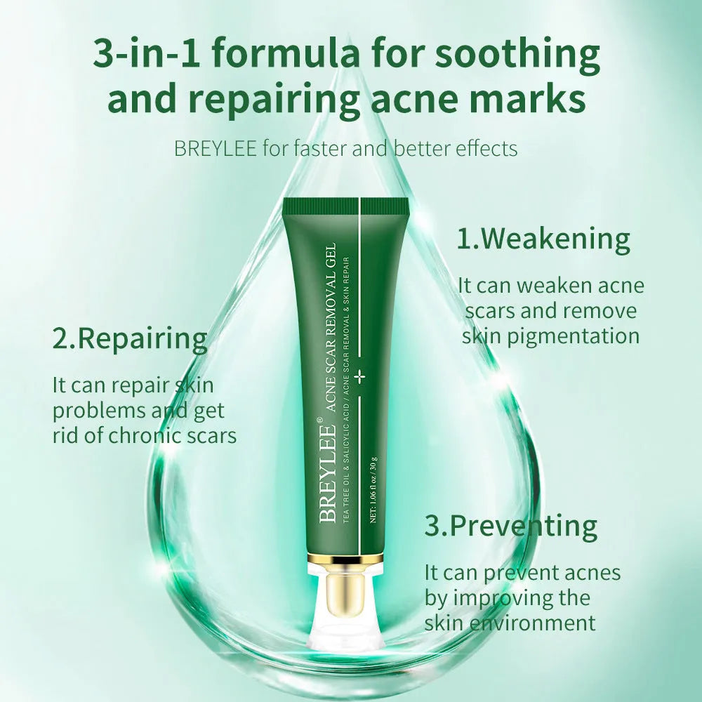 Acne scar removal gel with tea tree oil in a 30g green tube, Qu Dou Printing