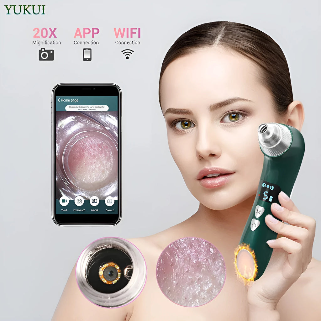 Rechargeable blackhead remover with hot compress, 54KPA suction, app control, green or white, USB charging