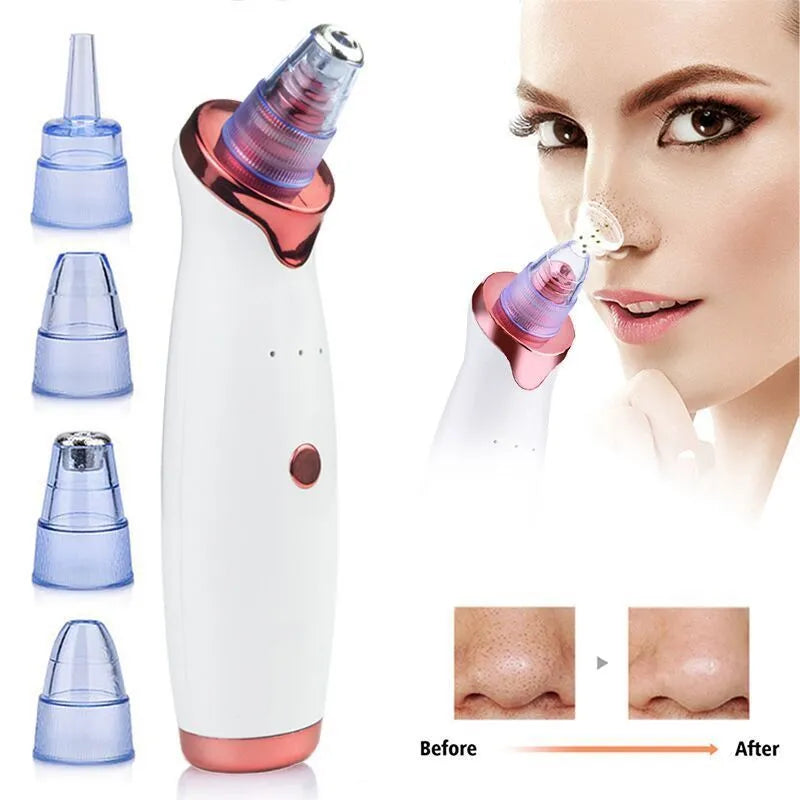 White ultrasonic acne cleaner beauty equipment with silicone head on clean background