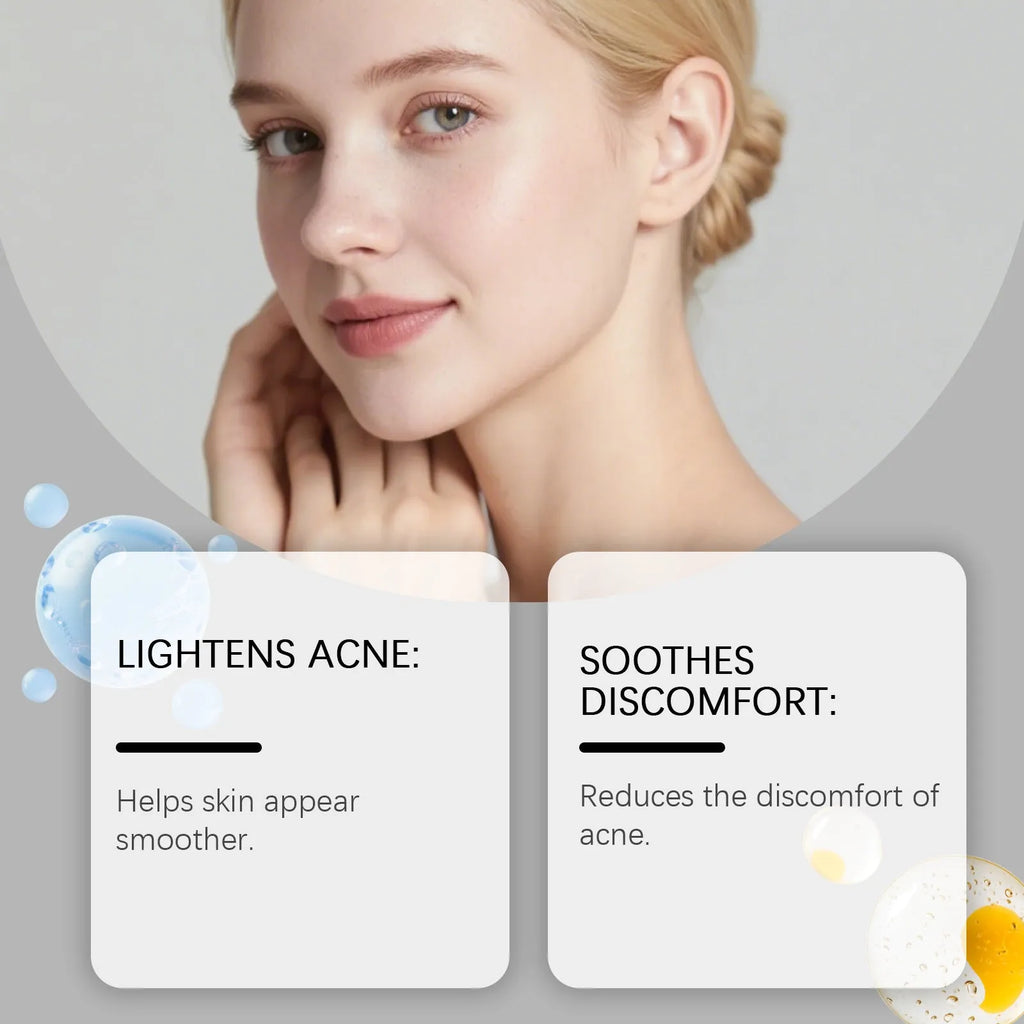 Pack of 80 gentle breathable facial acne patches for daily blemish care