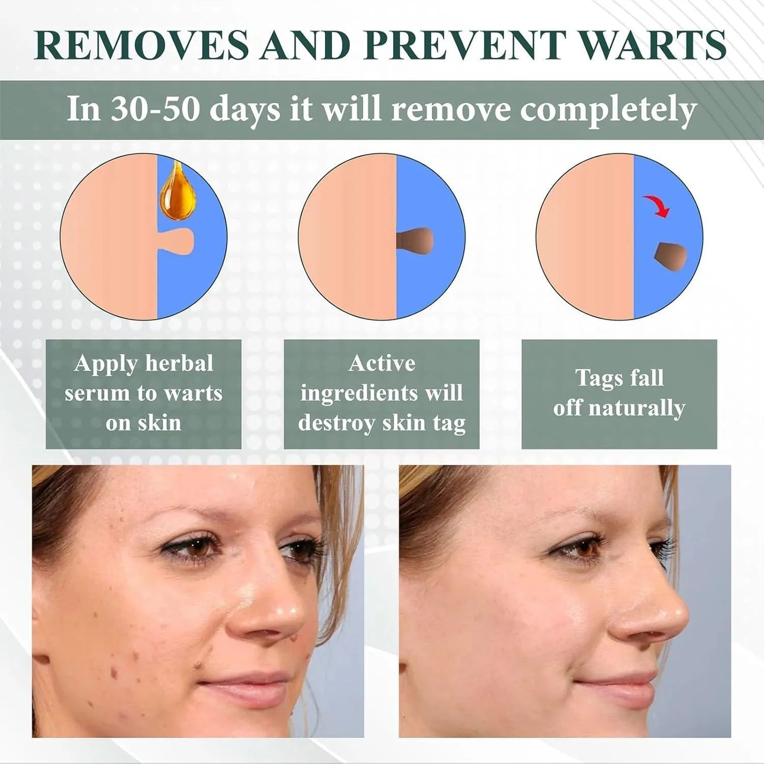 Natureerase Instant Mole Spot Removal Gel 45g tube on white background