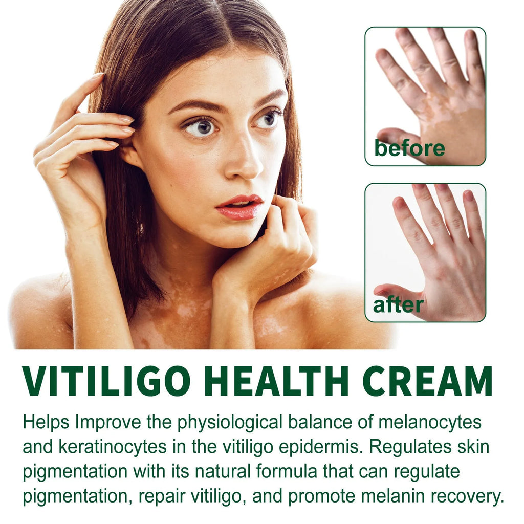 35g nursing cream container for body skin cleansing and moisturising treatment