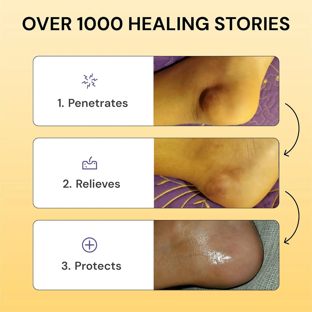 120g tube of Flare Care muscle and joint pain relief cream with no logo on packaging
