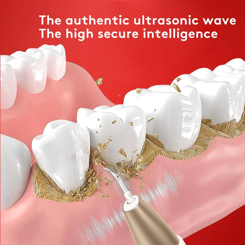 Gold ultrasonic tooth cleaner for stain and tartar removal oral care device